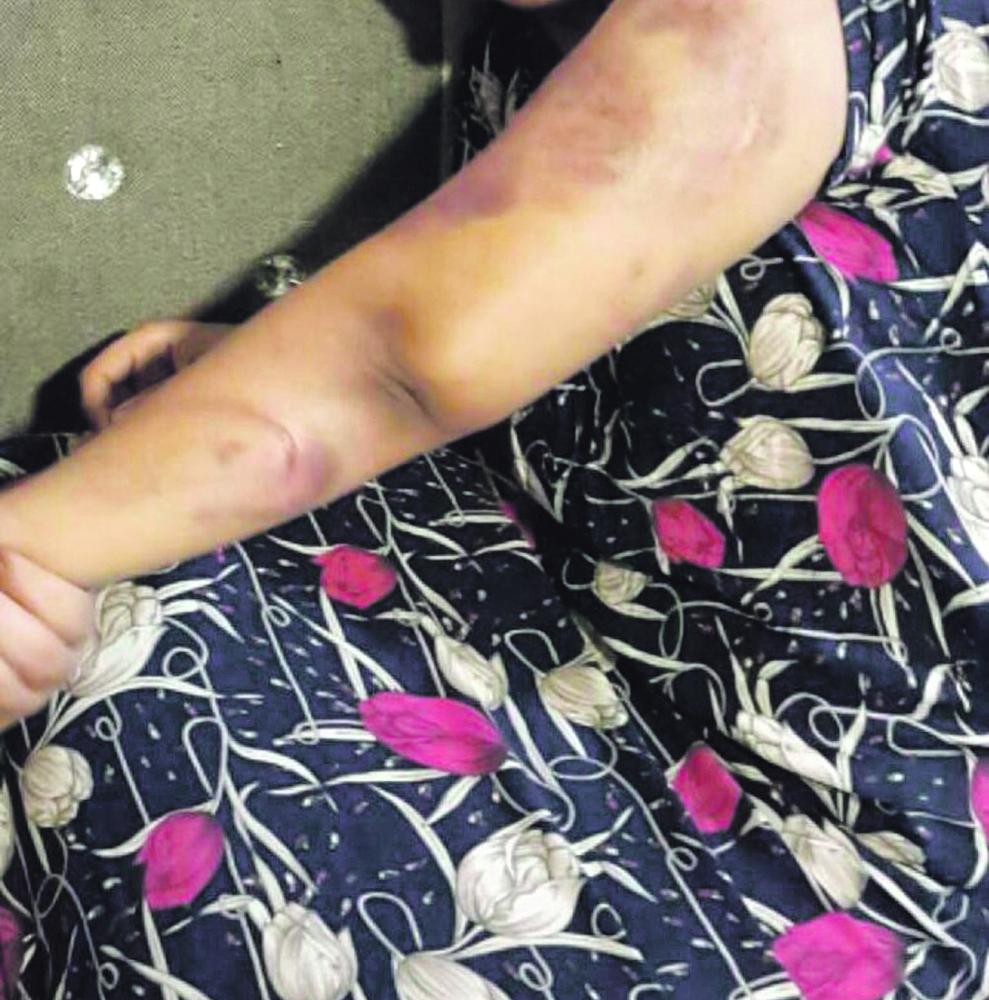 صفوى.. إحالة قضية الطفلة المعنفة للنيابة