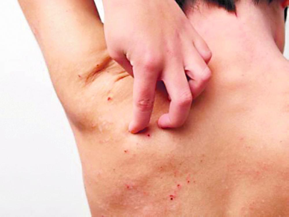 أعراض المرض من السهل تحديدها