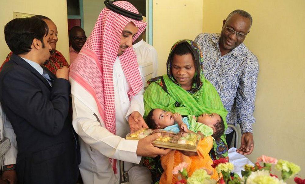 نقل التوأم السيامي التنزاني إلى المملكة لإجراء العملية 