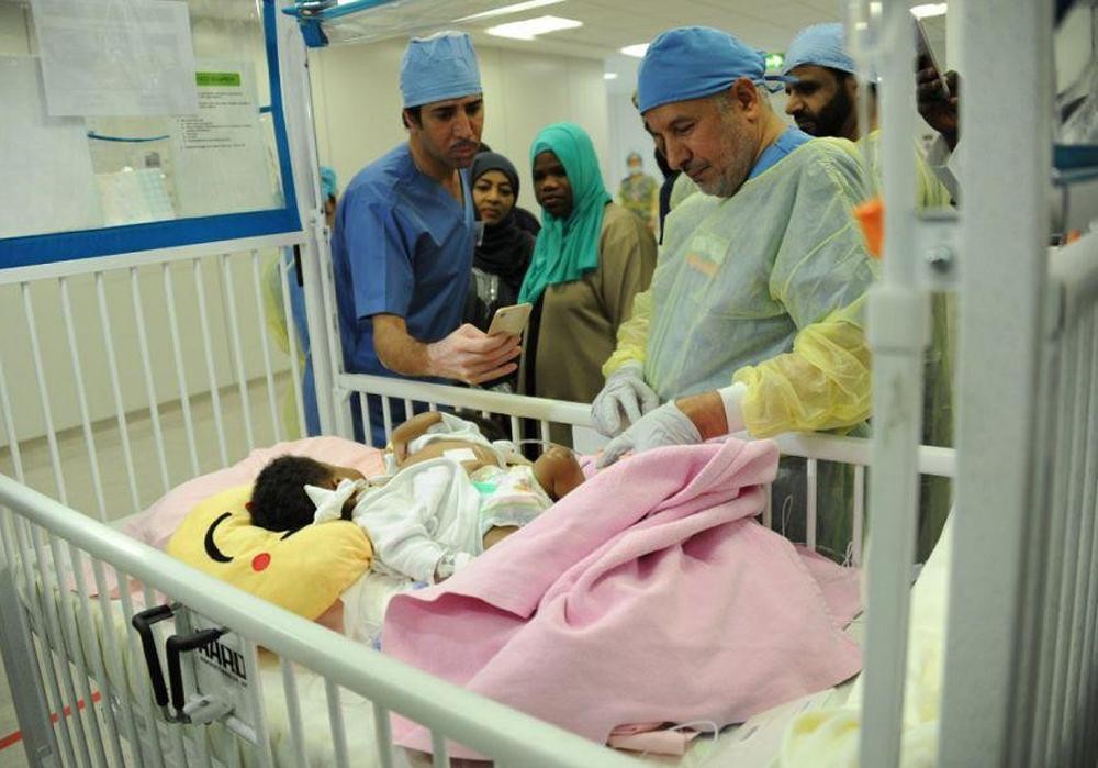 بالصور .. بدء عملية فصل التوأم التنزاني