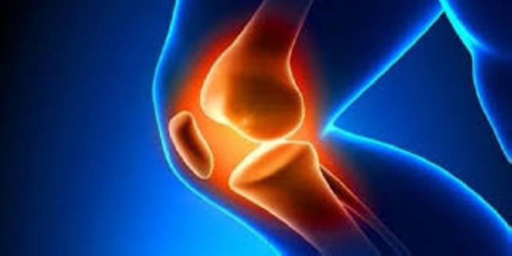 أول ركبة صناعية من طباعة الخلايا الحية!