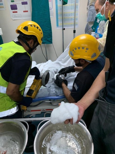 مدني الجبيل ينقذ طفلة بعد احتجاز يدها داخل فرامة