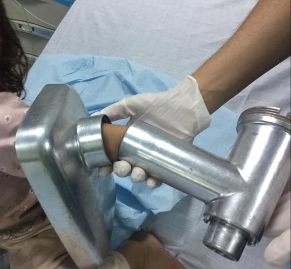 مدني الجبيل ينقذ طفلة بعد احتجاز يدها داخل فرامة