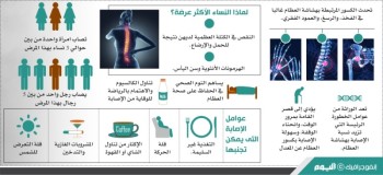 «هشاشة العظام».. الخطر الصامت