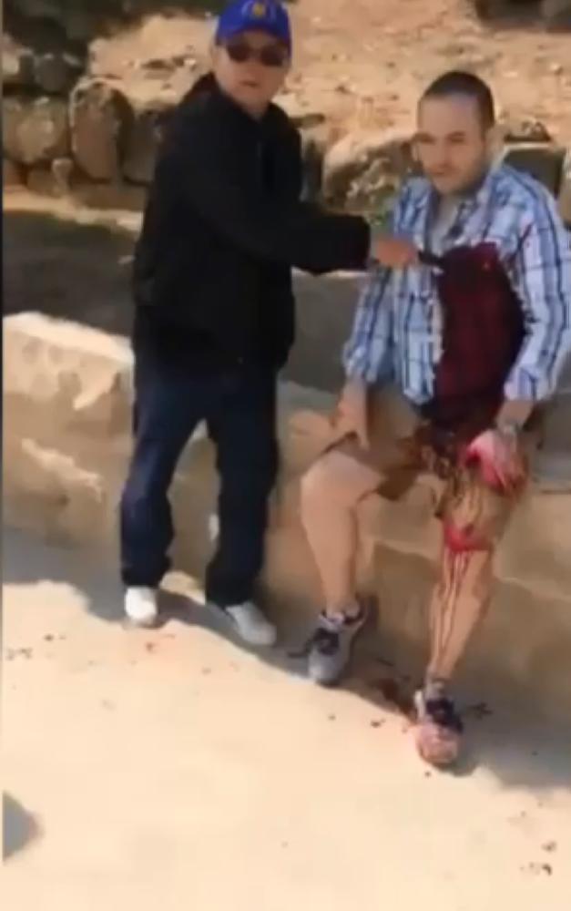 استقرار لحالة المصابين في حادث الطعن بجرش