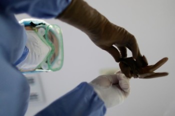  كورونا يأجل 28.4 عملية جراحية حول العالم 