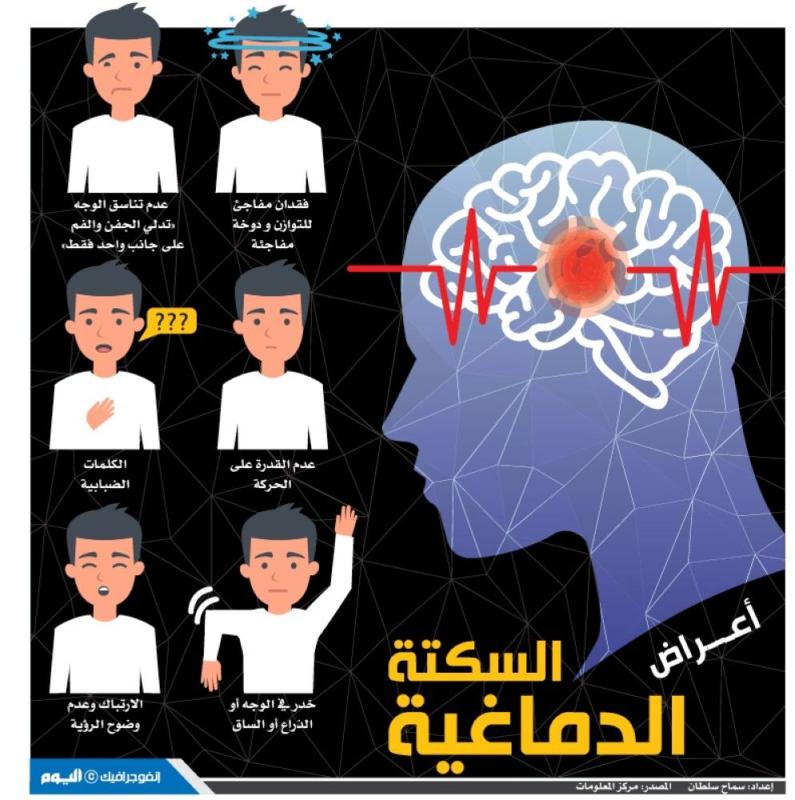 أعراض السكتة الدماغية
