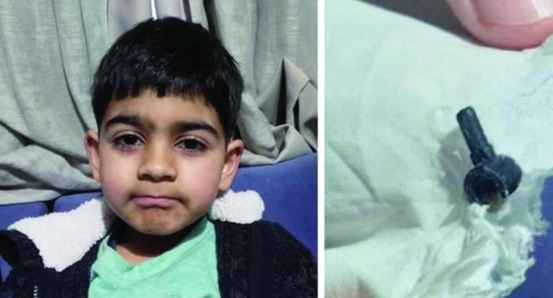 «ليجو» تسكن عامين بأنف طفل