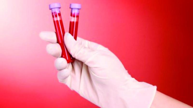 اختبار دم يتنبأ بخطر الذهان