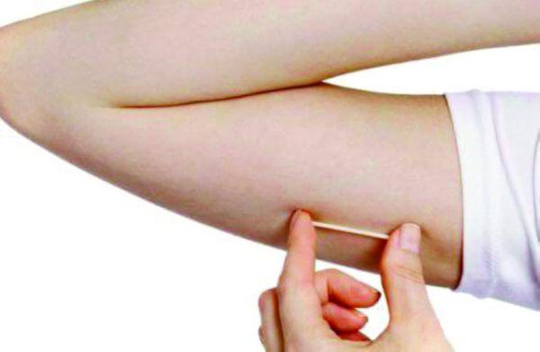 «زيادة الوزن» أبرز سلبيات شريحة منع الحمل