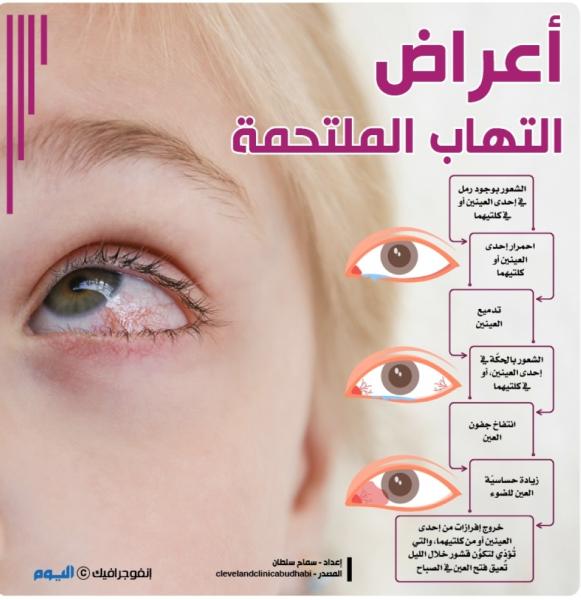 أعراض التهاب الملتحمة