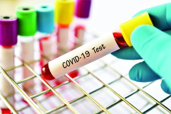 دراسة: خطر الوفاة من كورونا أعلى 3.5 مرة من الإنفلونزا