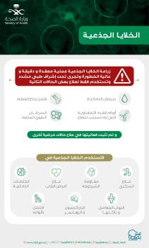 عاجل : «الصحة» تحذر من «الخلايا الجذعية» : عملية خطيرة تستخدم لـ 4 حالات فقط