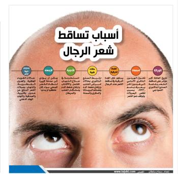 اسباب تساقط شعر الرجال