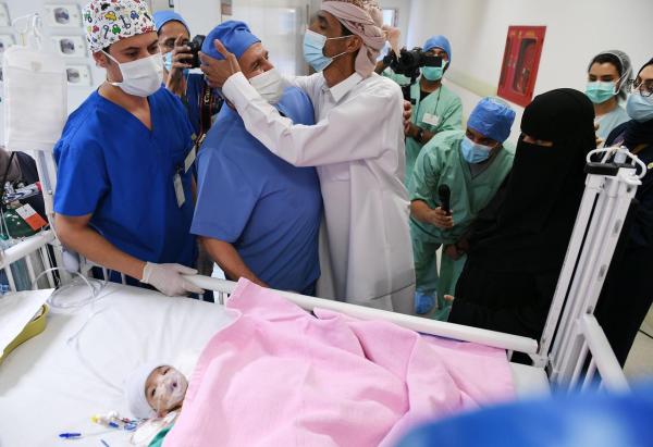 شاهد.. نجاح عملية فصل التوأم الطفيلي اليمني