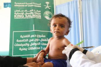 أكبر الداعمين لليمن .. المملكة الثالثة عالميًا في تقديم المساعدات