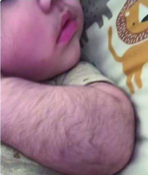 رضيع «مشعر»