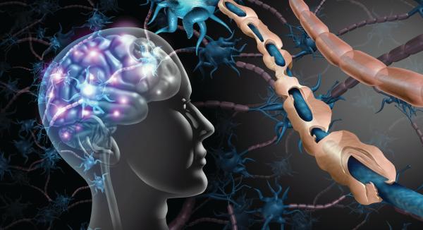 أطعمة تعزز صحة الدماغ7