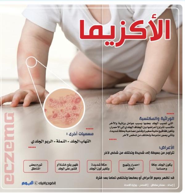 الأكزيما.. الأسباب والأعراض
