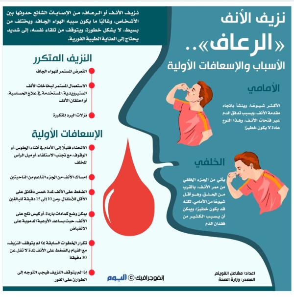 نزيف الأنف «الرعاف» الأسباب والإسعافات الأولية