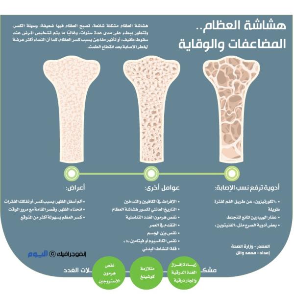 هشاشة العظام .. المضاعفات والوقاية