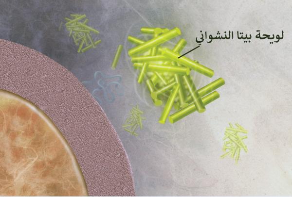 بخاخ أنفي.. علاج واعد للزهايمر