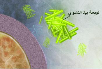 بخاخ أنفي.. علاج واعد للزهايمر