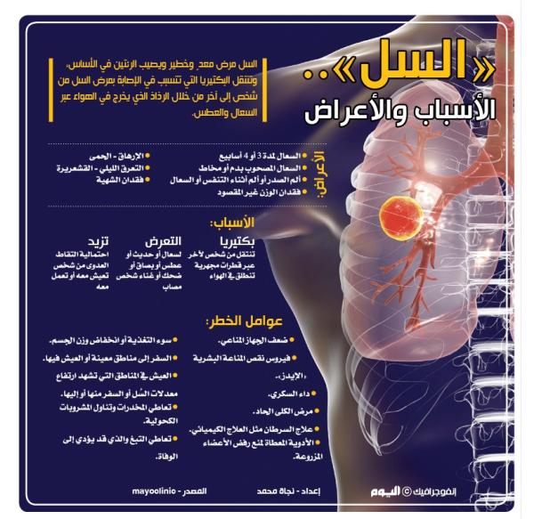 «السل».. الأسباب والأعراض