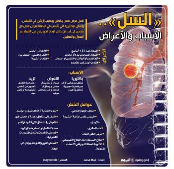 «السل».. الأسباب والأعراض