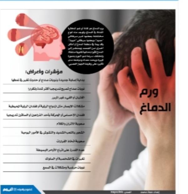 ورم الدماغ.. مؤشرات وأعراض
