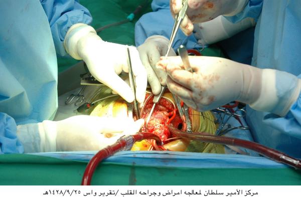 التبرع بالأعضاء..«فرصة جديدة للحياة»