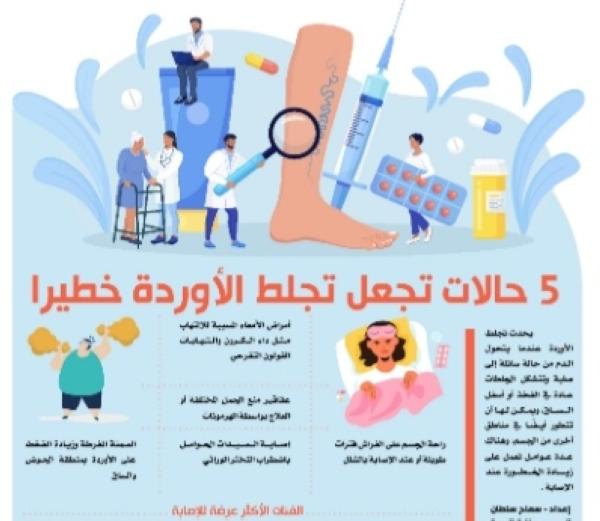 5 حالات تجعل تجلط الأوردة خطيرا