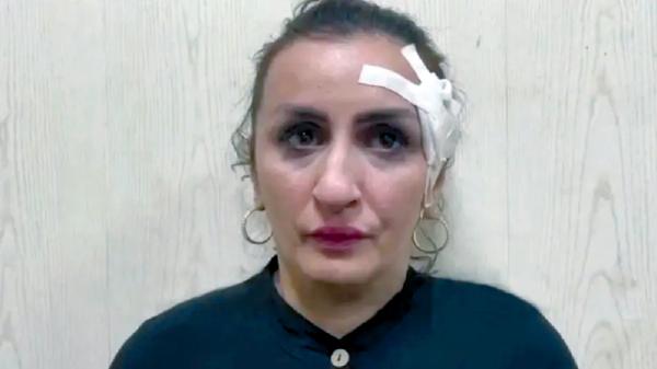 تبيع مولودها الرضيع لتجميل أنفها