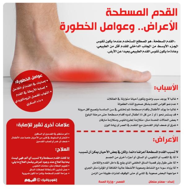 القدم المسطحة الأعراض .. وعوامل الخطورة