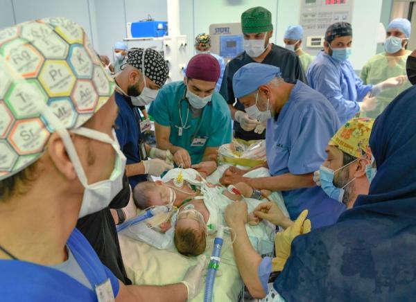 د. عبدالله الربيعة: تم فصل التوأم السيامي «مودة ورحمة» بنجاح