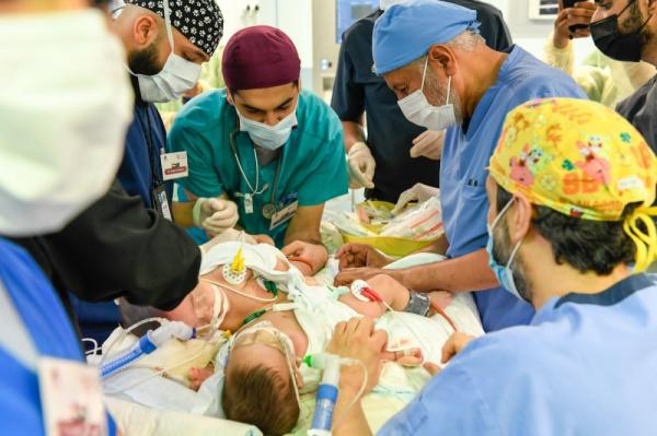 د. عبدالله الربيعة: تم فصل التوأم السيامي «مودة ورحمة» بنجاح