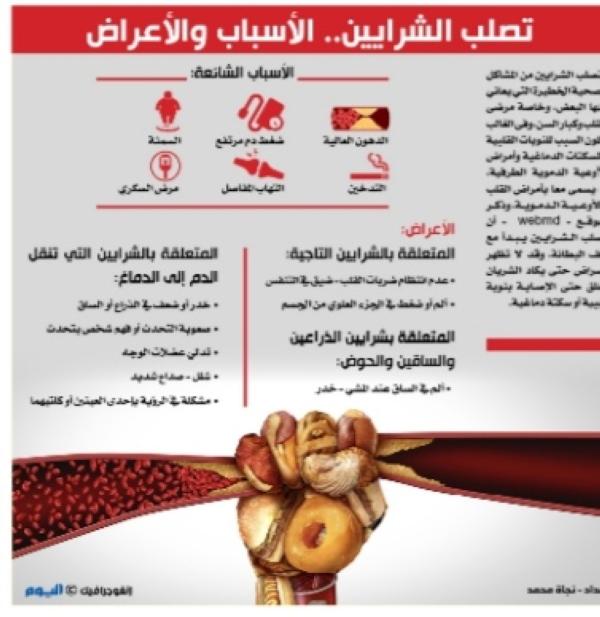 تصلب الشرايين.. الأسباب والأعراض