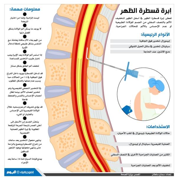 إبرة قسطرة الظهر
