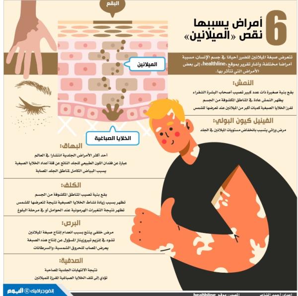6 أمراض يسببها نقص «الميلانين»