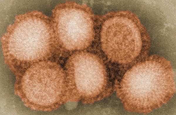 الجزائر ترصد تفشيا لـ «H5N1»