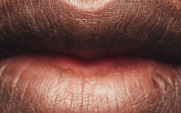 سوء التغذية من أهم أسباب جفاف الشفاه وتشققها - مشاع إبداعي