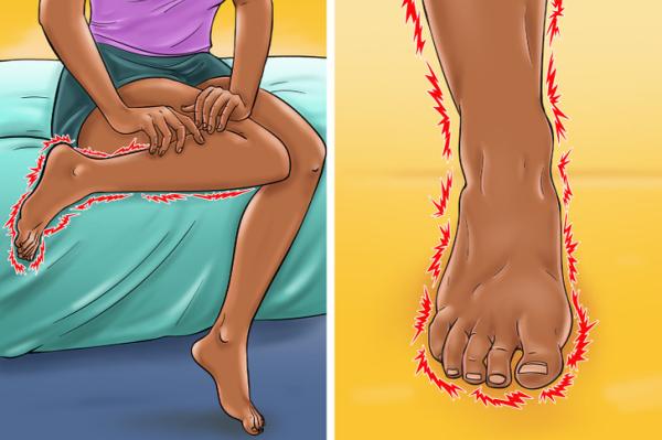 رطب قدميك والكاحل بمرطب أو بجل الفازلين- مشاع إبداعي