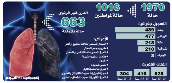 جدة الأعلى.. 1970 إصابة بالدرن الرئوي في المملكة
