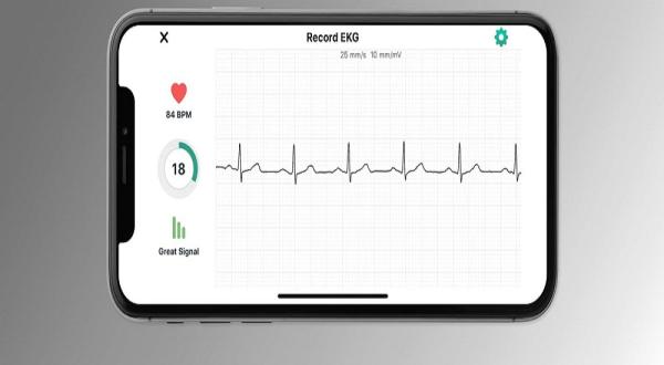 AliveCor تضع «ساعة آبل» أمام القضاء .. اعرف السبب