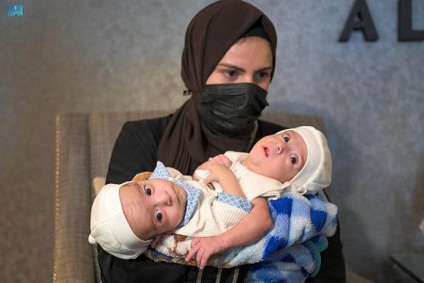 التوأم نقلا إلى غرفة العناية المركزة للأطفال لوضعهما تحت الرقابة خلال اليومين القادمين- واس