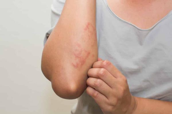 دلالة على خلل.. علامات تحذيرية يطلقها الجسد