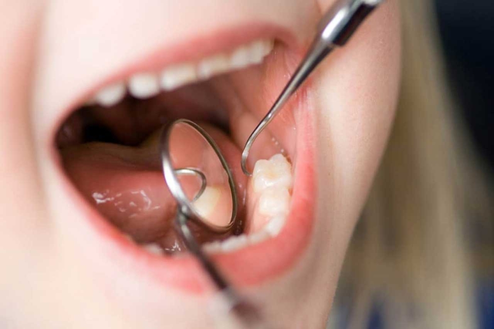 بدء تنفيذ قرار توطين مهن طب الأسنان اليوم - مشاع إبداعي