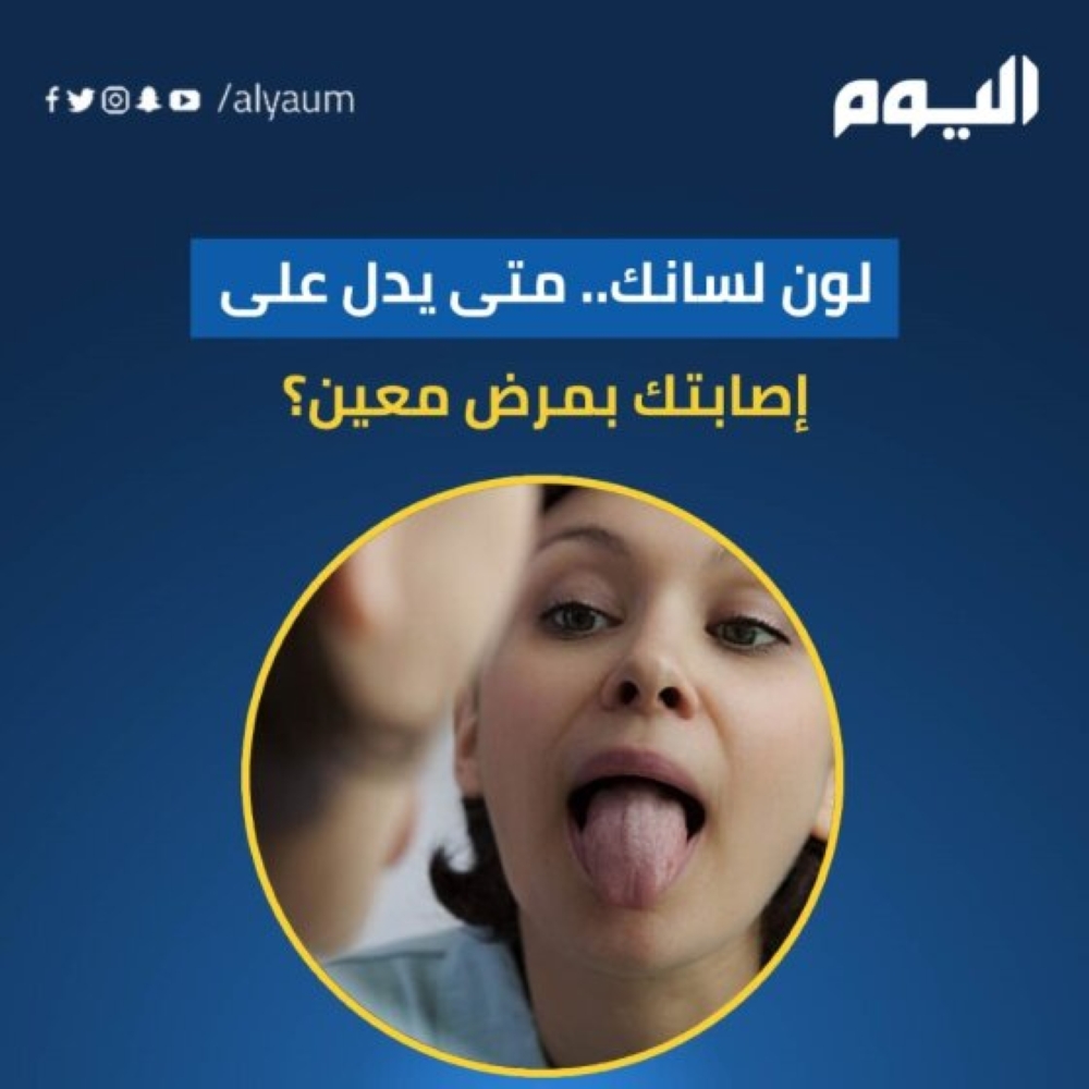 لون لسانك.. متى يدل على إصابتك بمرض معين؟