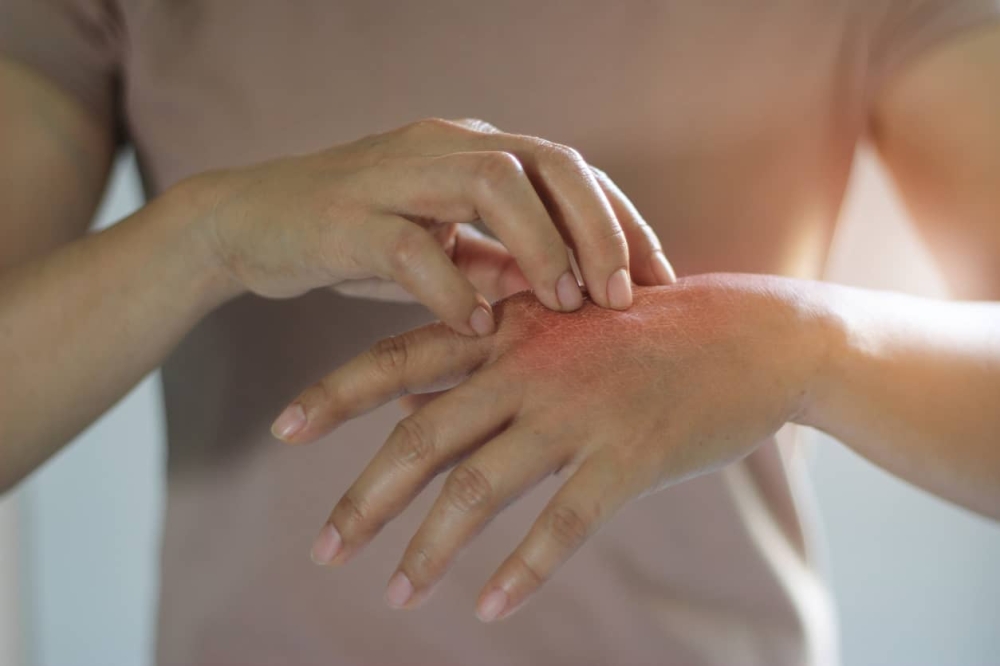 6 أسباب لتسلخات الجلد و4 طرق للعلاج