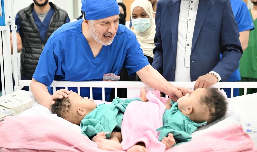 فصل التوأم الصومالي 'رحمة ورملا'.. و3 مراحل متبقية